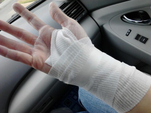 Hand dressing: $8, giant bloody gash: priceless.