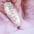 Acanthosis Nigricans in the groin (vagina). Acanthosis Nigricans in the groin (vagina).