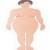 #5: Changes in body appearance associated with Acromegaly. #5: Changes in body appearance associated with Acromegaly.