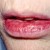 #2: Lip cracking is also common in cases of Dry Mouth. #2: Lip cracking is also common in cases of Dry Mouth.