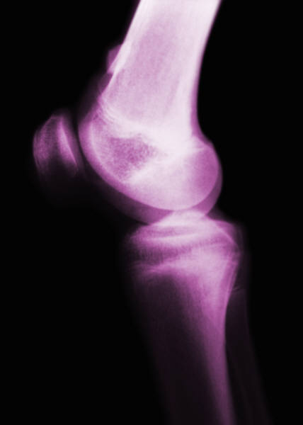 Bones