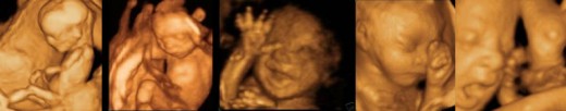3d Pregnancy Images