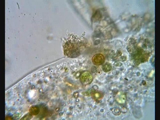 Amoeba proteus