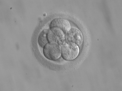 'This work has been released into the public domain by its author, ekem'. See: http://en.wikipedia.org/wiki/File:Embryo,_8_cells.jpg