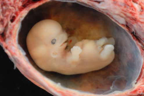 'Licensed under the Creative Commons Attribution 2.0 Generic license'. See: http://en.wikipedia.org/wiki/File:Human_Embryo_-_Approximately_8_weeks_estimated_gestational_age.jpg