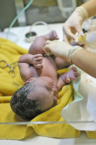 'This file is licensed under the Creative Commons Attribution-Share Alike 3.0 Unported license.' See: http://en.wikipedia.org/wiki/File:Umbilical-newborn.jpg