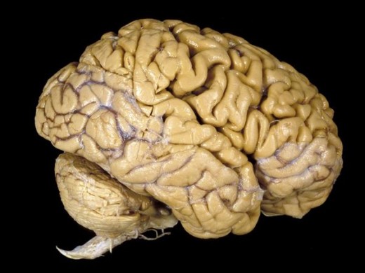 the human brain. it is a mass of jelly like substance. when a tumor develops and continues growing, it puts pressure on the brain tissue. this affects normal bodyfunction.