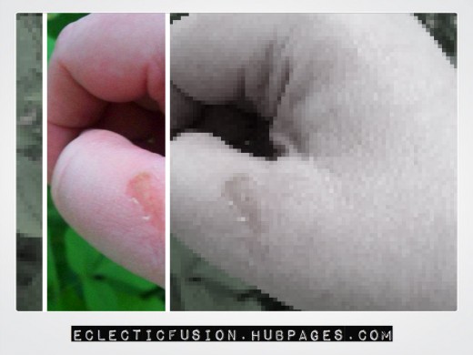 Blister! I was working so hard, I didn't even notice until I stopped for the day!