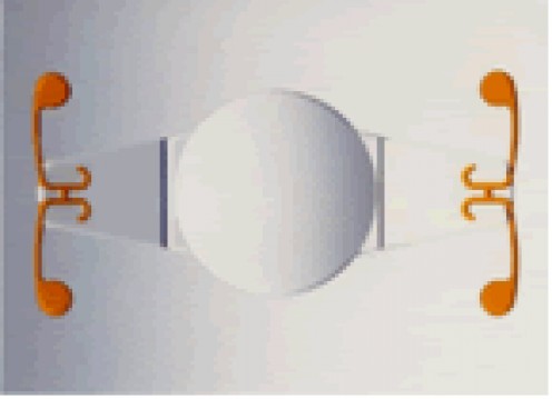 Crystalens AO Review - Results of an Intraocular Lens (IOL) Implant Crystalens AO Review - Results of an Intraocular Lens (IOL) Implant