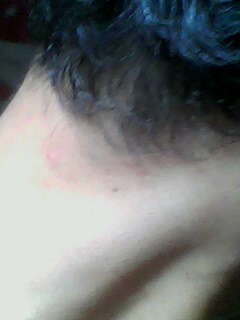 neck
