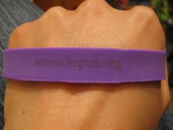 What Is Lupus?