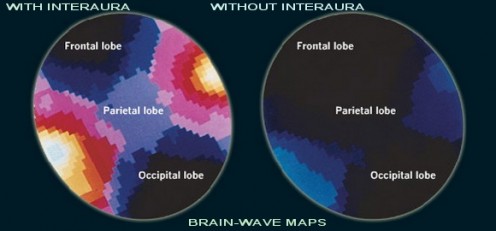The figure shows a brain scan of a patient who is undergoing hypnotic trance to control pain. As  you can see the image on the left is in a very excited state, the image to the right is almost in a deep sleep mode of relaxation. 