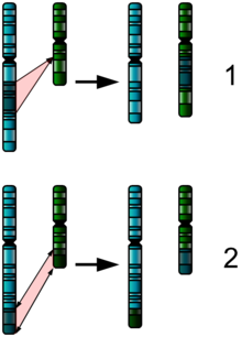 Structural abnormalities