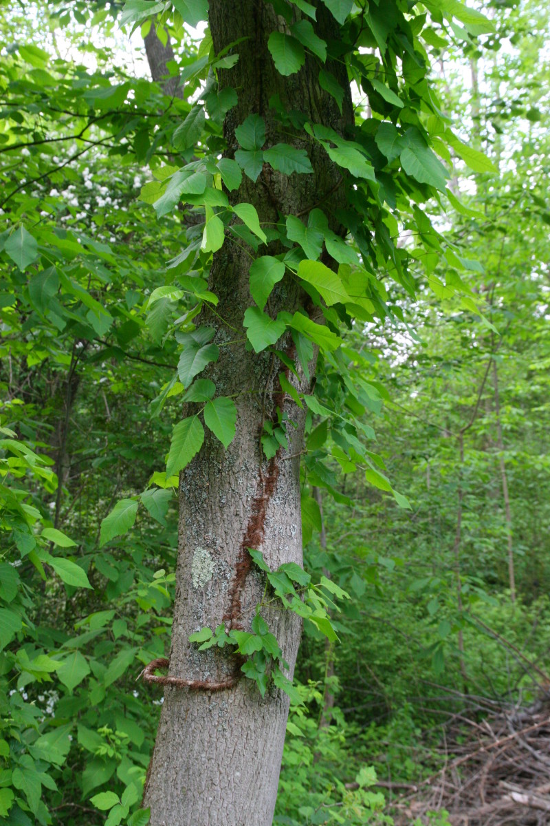 Steroid injection for poison ivy