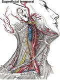 Giant Cell Arteritis Facts