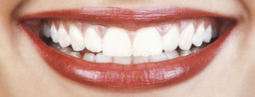 White Teeth beautifies your smile and increase your face value