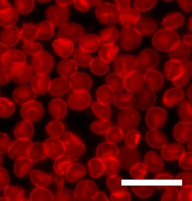 Red Blood Cells, unlike in CGI, cells are actually translucent and very flexible. Scale bar is 20micrometres wide.