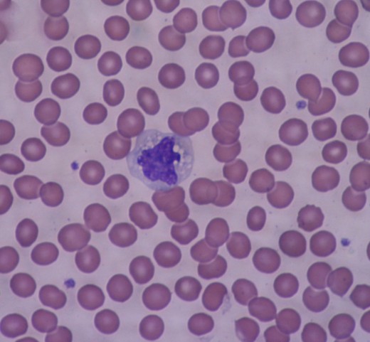 Monocytes are the largest type of blood cell - as can clearly be seen here.