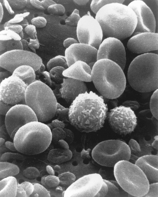 A Scanning Electron Micrograph image from normal human blood. You can see red blood cells, several white blood cells including lymphocytes, a monocyte, a neutrophil, and many small disc-shaped platelets.