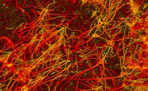 NEURONS OF THE HUMAN BRAIN 