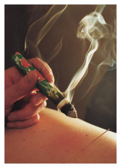 What is Acupuncture and Traditional Chinese Medicine (TCM)?