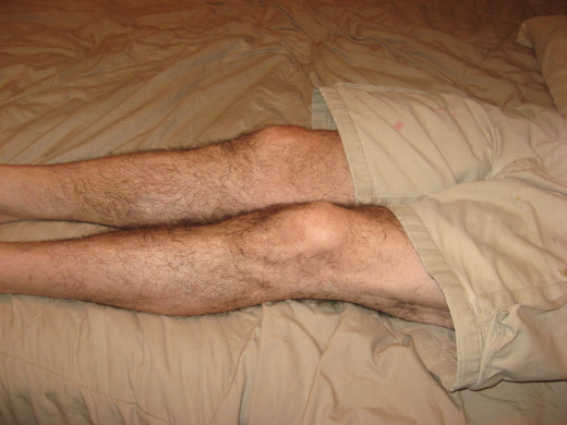 Hubby's restless legs.
