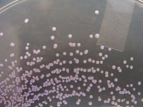 Staphylococcus saprophyticus isolate from a urine from a 21 year old pregnant female with proteinuria and a high urinary leucocyte count.
