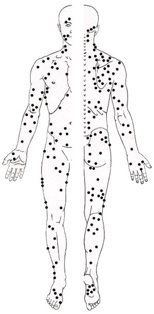 As you can see, the body is full of trigger points. There are several in the area of the glutes that affect low back pain.
