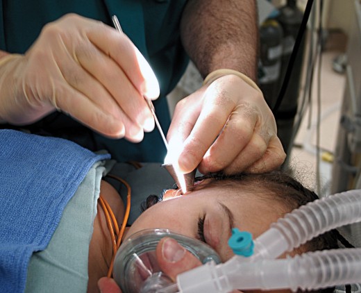 Ventilation tubes, or grommets, may be placed in the eardrum to help children with glue ear. This procedure allows fluid to drain down the Eustachian tubes.