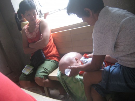 A baby with hydrocephalus
