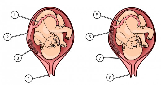 The placenta is an organ unique to mammals that connects the developing fetus to the uterine wall. The placenta supplies the fetus with oxygen and food, and allows fetal waste