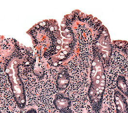 Figure 1. Damaged intestinal villi!