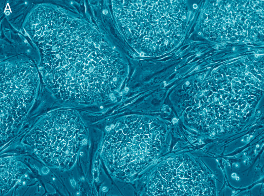 Embryonic stem cells, as seen under a microscope.