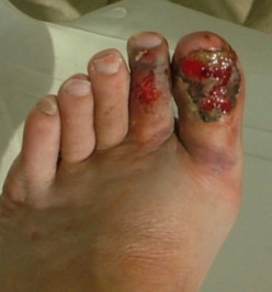 Warning: Flip-flops are a health hazard