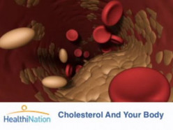 Cholesterol: Bad or Good and What You Don't Know
