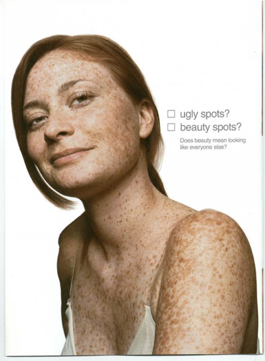 Ugly Spots? Beauty Spots? Does Beauty mean looking like everyone else? 