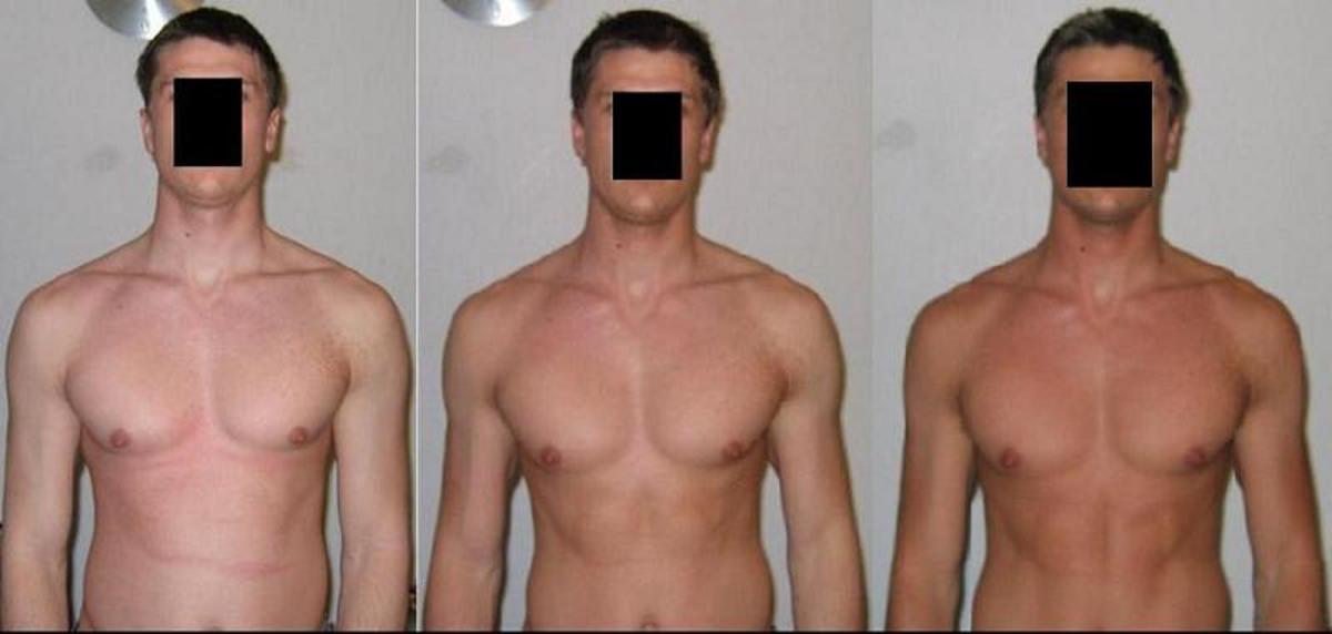 Before And After Tanning Injections