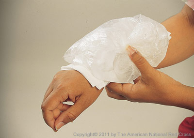 Place ice pack on wound to slow down bleeding