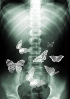 Butterflies in the Stomach