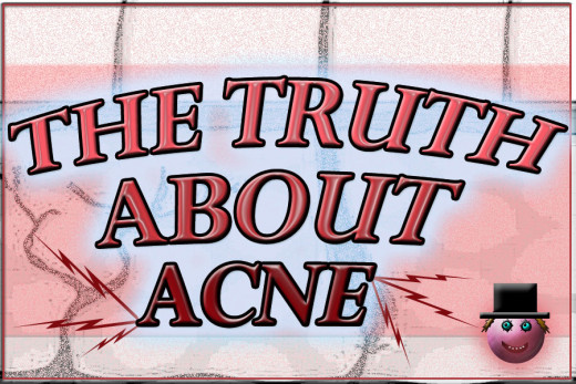 The truth about acne can be hard to find!