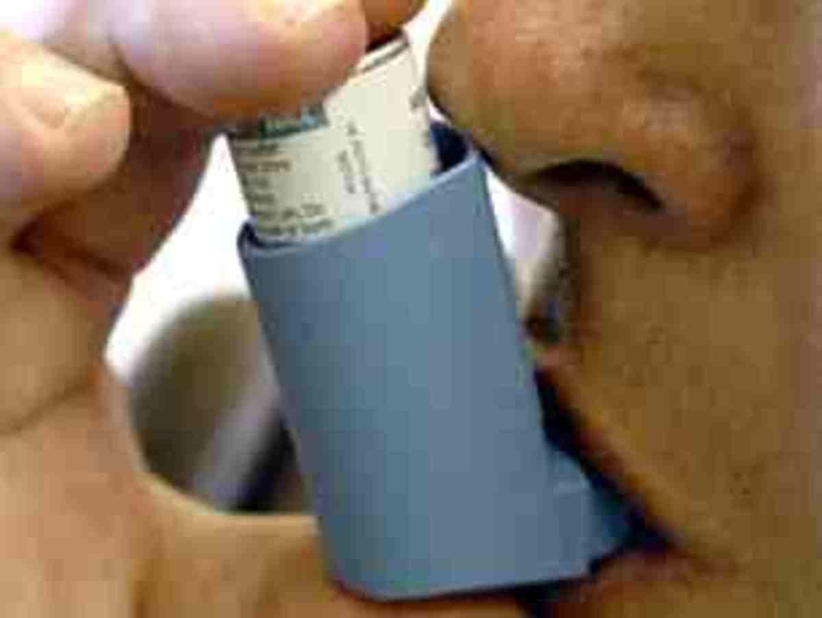 Asthma public domain