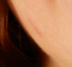 This scratch did not completely disappear after the initial PP11 edit.
