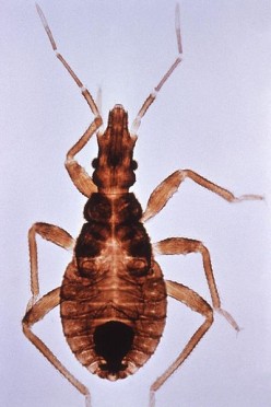 The Kissing Bug and Chagas Disease