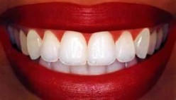 Ways to Reduce Plaque Buildup on Teeth