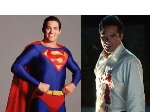 Dean Cain as Superman (Lois and Clark) and Dr. Curtis Knox (Smallville) 