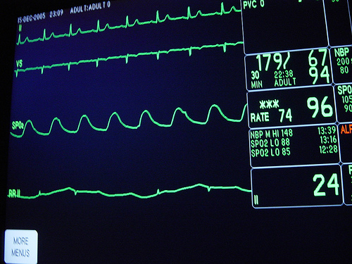 The incidence of cardiovascular disease increased for those who experienced chronic insomnia over a long period of time.