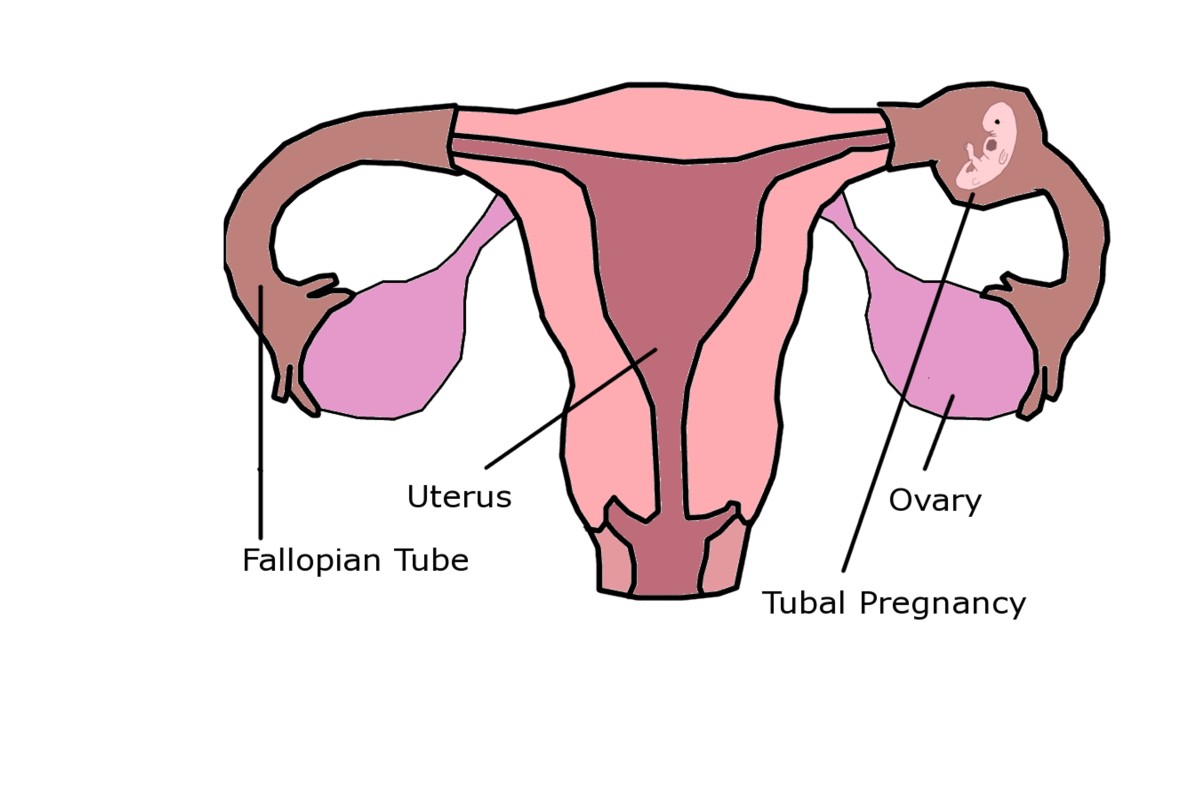 Pregnancy Hormone Level Chart