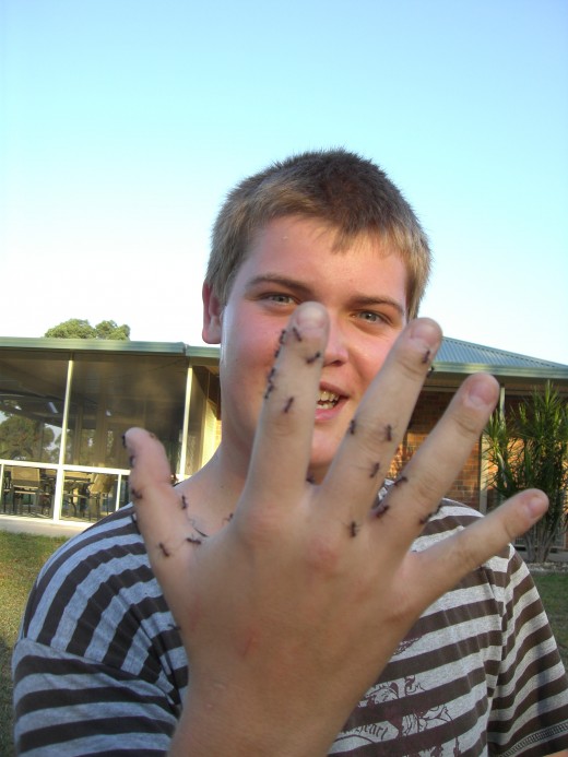 My son after putting his hand into a Meat Ants nest