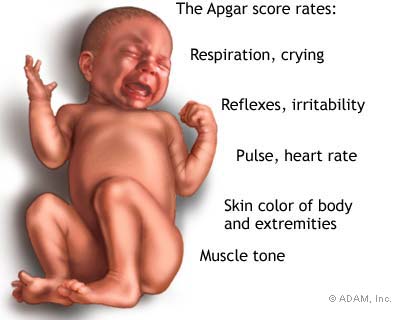 The Apgar score is used to evaluate a newborn's need for immediate care such as suction of airways; babies usually improve with this follow-up treatment.  