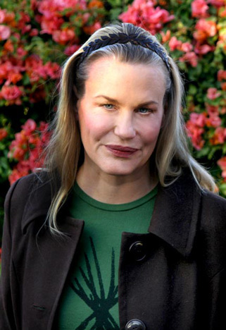After plastic surgery.